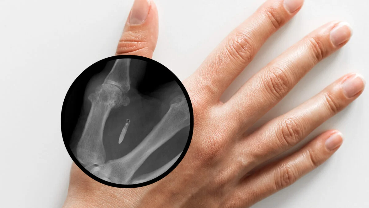 Washington May Soon Ban Mandatory Employee Microchips