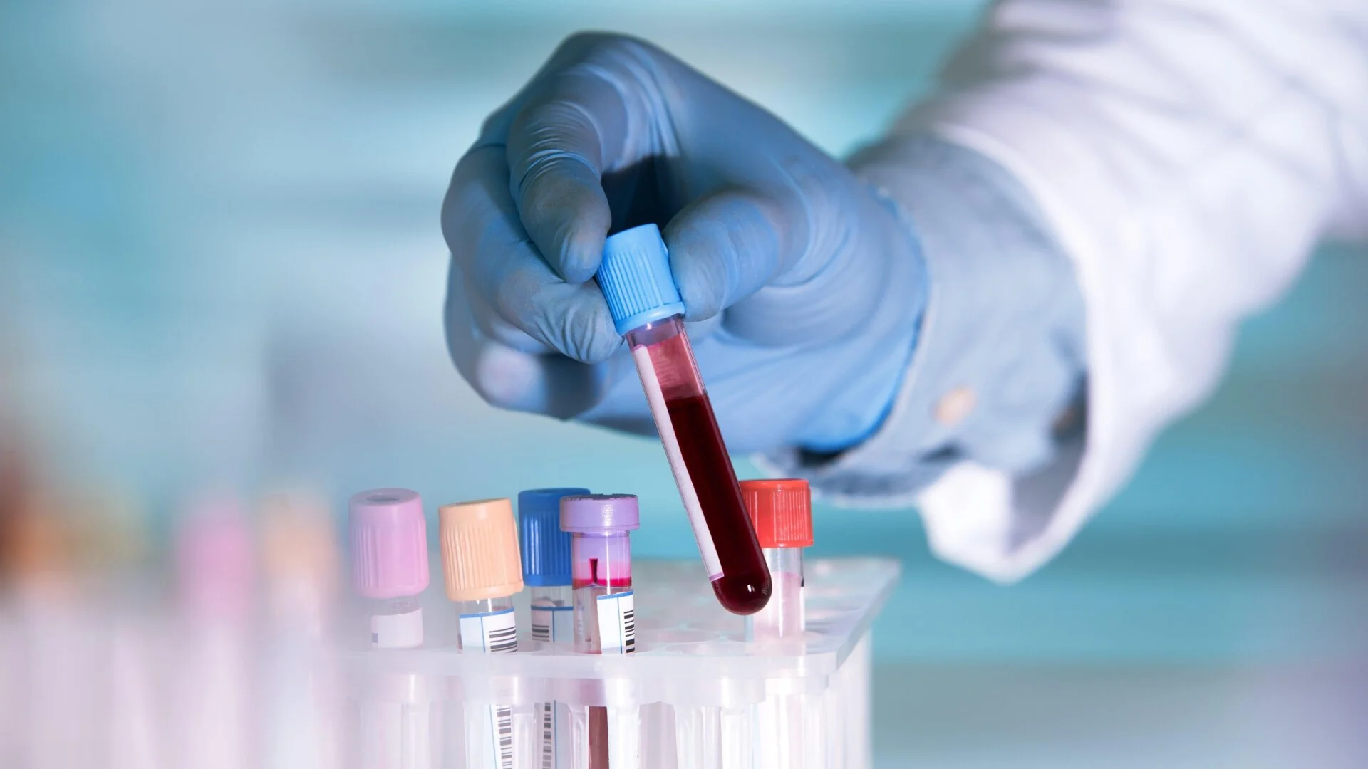 Study Finds AI-Generated Drug Could Slow Aging