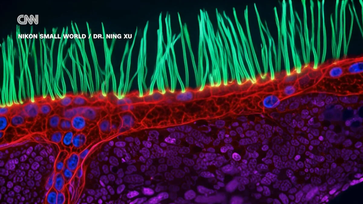 Nikon Contest Winner's Microscope Video Uses AI, Scientists Object